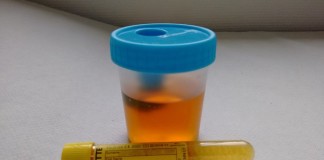 The way of prostate cancer diagnostics