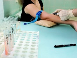 La fase preanalítica es la principal causa de errores en el laboratorio clínico