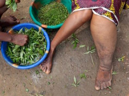 Lymphatic filariasis