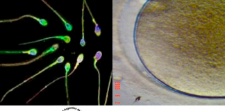 Curso bases fisiológicas y moleculares del proceso de fertilización. Aplicación al diagnóstico andrológico